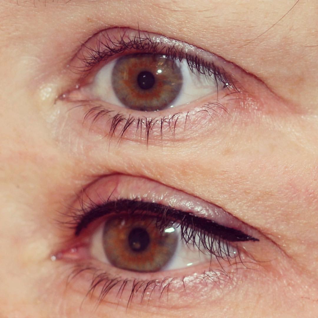 Permanent Eyes before and after image