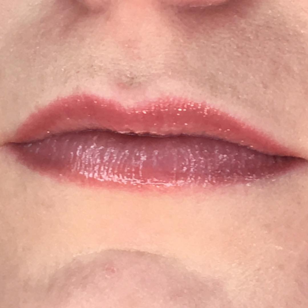 Permanent Lips before and after image
